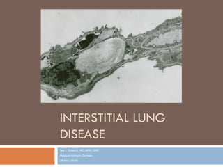 INTERSTITIAL LUNG
DISEASE
Tee L. Guidotti, MD, MPH, DABT
Medical Advisory Services
OEMAC 2010
 