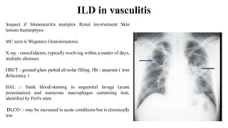 Sequential Bal Interstitial lung disease | PPTX