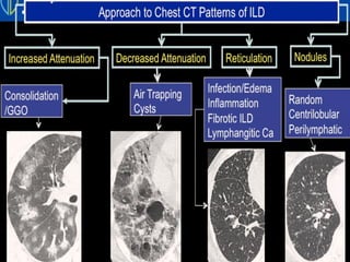 INTERSTITIAL LUNG DISEASE HRCT APPROACH.pptx