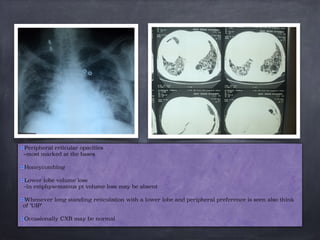 Peripheral reticular opacities
–most marked at the bases

Honeycombing

Lower lobe volume loss
–in emphysematous pt volume loss may be absent

Whenever long standing reticulation with a lower lobe and peripheral preference is seen also think
of ‘UIP’

Occasionally CXR may be normal
 