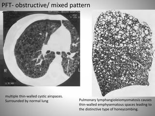PFT and Interstitial lung diseases | PPTX