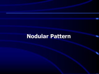 Nodular Pattern
 