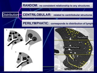 RANDOM: no consistent relationship to any structures
PERILYMPHATIC: corresponds to distribution of lymphatic
CENTRILOBULAR: related to centrilobular structuresDistribution
113
 