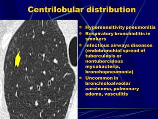 Centrilobular distribution
Hypersensitivity pneumonitis
Respiratory bronchiolitis in
smokers
infectious airways diseases
(endobronchial spread of
tuberculosis or
nontuberculous
mycobacteria,
bronchopneumonia)
Uncommon in
bronchioloalveolar
carcinoma, pulmonary
edema, vasculitis
 