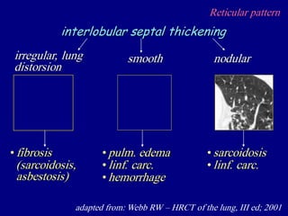 Reticular pattern
adapted from: Webb RW – HRCT of the lung, III ed; 2001
interlobular septal thickening
irregular, lung
distorsion
nodularsmooth
•fibrosis
(sarcoidosis,
asbestosis)
•pulm. edema
•linf. carc.
•hemorrhage
• sarcoidosis
• linf. carc.
 