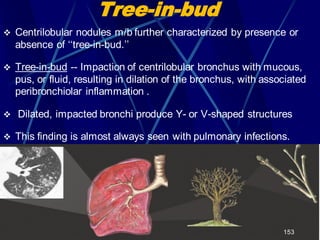 Tree-in-bud
 Centrilobular nodules m/b further characterized by presence or
absence of „„tree-in-bud.‟‟
 Tree-in-bud -- Impaction of centrilobular bronchus with mucous,
pus, or fluid, resulting in dilation of the bronchus, with associated
peribronchiolar inflammation .
 Dilated, impacted bronchi produce Y- or V-shaped structures
 This finding is almost always seen with pulmonary infections.
153
 