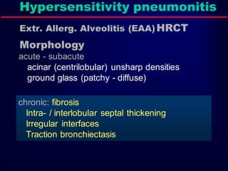 Hypersensitivity pneumonitis
Extr. Allerg. Alveolitis (EAA) HRCT
Morphology
chronic: fibrosis
Intra- / interlobular septal thickening
Irregular interfaces
Traction bronchiectasis
acute - subacute
acinar (centrilobular) unsharp densities
ground glass (patchy - diffuse)
 