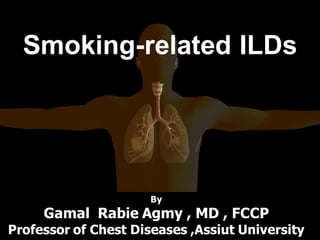 Smoking-related ILDs
By
Gamal Rabie Agmy , MD , FCCP
Professor of Chest Diseases ,Assiut University
 