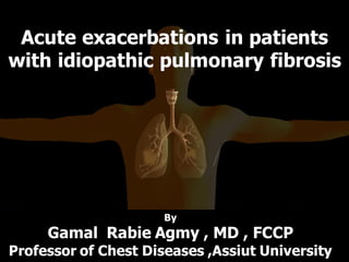 Acute exacerbations in patients
with idiopathic pulmonary fibrosis
By
Gamal Rabie Agmy , MD , FCCP
Professor of Chest Diseases ,Assiut University
 