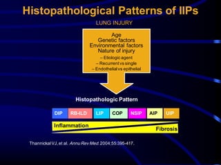 Histopathological Patterns of IIPs
ThannickalVJ,et al. Annu Rev Med.2004;55:395-417.
Age
Genetic factors
Environmental factors
Nature of injury
– Etiologic agent
– Recurrentvs single
– Endothelialvs epithelial
Histopathologic Pattern
DIP RB-ILD LIP COP NSIP AIP UIP
Inflammation
Fibrosis
LUNG INJURY
 