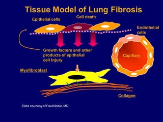 Epithelial cells
Collagen
Myofibroblast
Cell death
Growth factors and other
products of epithelial
cell Injury
Slide courtesyof PaulNoble,MD.
Tissue Model of Lung Fibrosis
Capillary
Endothelial
cells
 