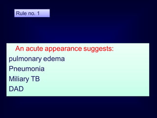 An acute appearance suggests:
pulmonary edema
Pneumonia
Miliary TB
DAD
Rule no. 1
 