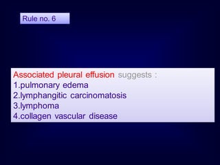 Associated pleural effusion suggests :
1.pulmonary edema
2.lymphangitic carcinomatosis
3.lymphoma
4.collagen vascular disease
Rule no. 6
 