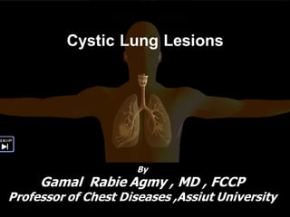 Cystic Lung Lesions
By
Gamal Rabie Agmy , MD , FCCP
Professor of Chest Diseases ,Assiut University
 