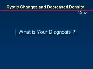 What is Your Diagnosis ?
Cystic Changes and Decreased Density
Quiz
 