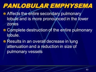 PANLOBULAR EMPHYSEMA
Affects the entire secondary pulmonary
lobule and is more pronounced in the lower
zones
Complete destruction of the entire pulmonary
lobule.
Results in an overall decrease in lung
attenuation and a reduction in size of
pulmonary vessels
83
 