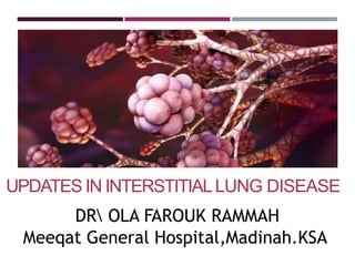 UPDATES IN INTERSTITIALLUNG DISEASE
DR OLA FAROUK RAMMAH
Meeqat General Hospital,Madinah.KSA
 