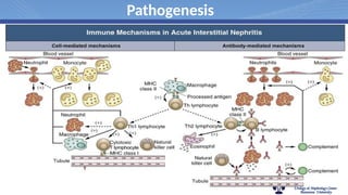 interstitial nephritis,acute and chronic | PPTX