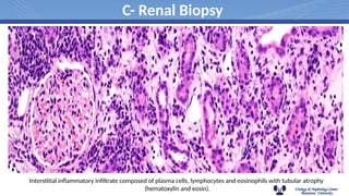 interstitial nephritis,acute and chronic | PPTX