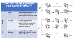 Comprehensive Overview of Intertrochanteric Femur Fractures: Diagnosis ...