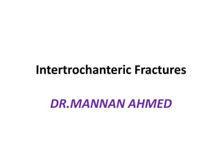 Intertrochanteric Fractures
DR.MANNAN AHMED
 