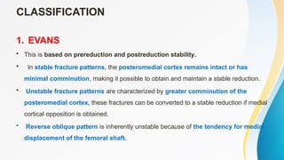 Comprehensive Overview of Intertrochanteric Femur Fractures: Diagnosis ...