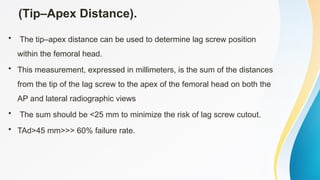 Comprehensive Overview of Intertrochanteric Femur Fractures: Diagnosis ...