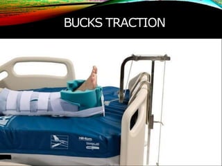 BUCKS TRACTION
 