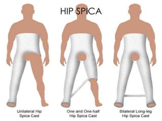 HIP SPICA 
 