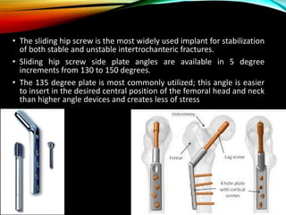 • The sliding hip screw is the most widely used implant for stabilization 
of both stable and unstable intertrochanteric fractures. 
• Sliding hip screw side plate angles are available in 5 degree 
increments from 130 to 150 degrees. 
• The 135 degree plate is most commonly utilized; this angle is easier 
to insert in the desired central position of the femoral head and neck 
than higher angle devices and creates less of stress 
 