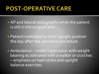 ◾ AP and lateral radiographs while the patient
is still in the surgical area
◾ Patient mobilized to chair upright position
the day after the operative procedure
◾ Ambulation – under supervision with weight
bearing as tolerated with a walker or crutches
– emphasis on heel-strike and upright
balance exercises
 