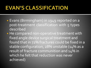 ◾ Evans (Birmingham) in 1949 reported on a
post-treatment classification with 5 types
described
◾ He compared non-operative treatment with
fixed angle device surgical treatment and
found that in 72% fractures could be fixed in a
stable configuration, 28% unstable (14% as a
result of fracture communition and 14% in
which he felt that reduction was never
achieved)
 