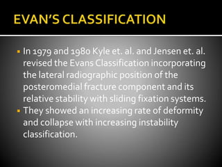◾ In 1979 and 1980 Kyle et. al. and Jensen et. al.
revised the Evans Classification incorporating
the lateral radiographic position of the
posteromedial fracture component and its
relative stability with sliding fixation systems.
◾ They showed an increasing rate of deformity
and collapse with increasing instability
classification.
 