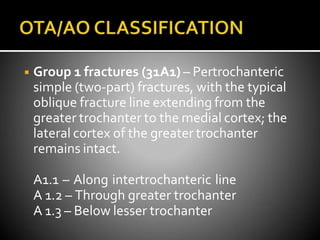 ◾ Group 1 fractures (31A1) – Pertrochanteric
simple (two-part) fractures, with the typical
oblique fracture line extending from the
greater trochanter to the medial cortex; the
lateral cortex of the greater trochanter
remains intact.
A1.1 – Along intertrochanteric line
A 1.2 – Through greater trochanter
A 1.3 – Below lesser trochanter
 