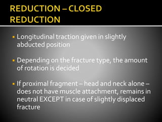 ◾ Longitudinal traction given in slightly
abducted position
◾ Depending on the fracture type, the amount
of rotation is decided
◾ If proximal fragment – head and neck alone –
does not have muscle attachment, remains in
neutral EXCEPT in case of slightly displaced
fracture
 