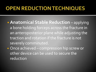 ◾Anatomical Stable Reduction – applying
a bone holding forceps across the fracture in
an anteroposterior plane while adjusting the
traction and rotation if the fracture is not
severely comminuted.
◾ Once achieved – compression hip screw or
other device can be used to secure the
reduction
 
