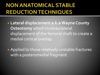 ◾ Lateral displacement a.k.aWayne County
Osteotomy which involves lateral
displacement of the femoral shaft to create a
medial cortical overlap.
◾ Applied to those relatively unstable fractures
with a posteromedial fragment
 