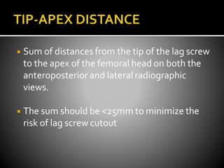 ◾ Sum of distances from the tip of the lag screw
to the apex of the femoral head on both the
anteroposterior and lateral radiographic
views.
◾ The sum should be <25mm to minimize the
risk of lag screw cutout
 