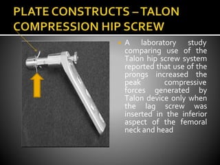 ◾ A laboratory study
comparing use of the
Talon hip screw system
reported that use of the
prongs increased the
peak compressive
forces generated by
Talon device only when
the lag screw was
inserted in the inferior
aspect of the femoral
neck and head
 