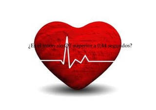 ¿Es el intervalo QT superior a 0,44 segundos?
 
