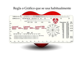 Regla o Gráfico que se usa habitualmente
 