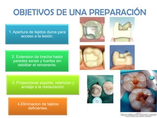 OBJETIVOS DE UNA PREPARACIÓN
1. Apertura de tejidos duros para
acceso a la lesión.

2. Extension de brecha hasta
paredes sanas y fuertes sin
debilitar el remanente.

3. Proporcionar soporte, retencion y
anclaje a la restauracion.

4.Eliminacion de tejidos
deficientes.

 
