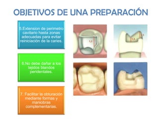 OBJETIVOS DE UNA PREPARACIÓN
5.Extension de perimetro
cavitario hasta zonas
adecuadas para evitar
reiniciación de la caries.

6.No debe dañar a los
tejidos blandos
peridentales.

7. Facilitar la obturación
mediante formas y
maniobras
complementarias.

 