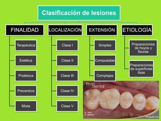 Clasificación de lesiones
FINALIDAD

LOCALIZACIÓN

EXTENSIÓN

Terapéutica

Clase I

Simples

Estética

Clase II

ETIOLOGÍA
Preparaciones
de hoyos y
fisuras

Compuestas

Protésica

Clase III

Preventiva

Clase IV

Mixta

Clase V

Complejas

Preparaciones
de superficies
lisas

 