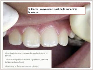 5. Hacer un examen visual de la superficie
humeda

 