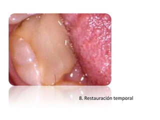 8. Restauración temporal

 