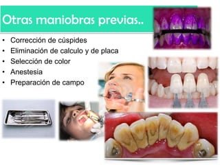 Otras maniobras previas..
•
•
•
•
•

Corrección de cúspides
Eliminación de calculo y de placa
Selección de color
Anestesia
Preparación de campo

 