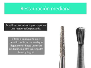 Restauración mediana
Se utilizan los mismos pasos que en
una restauración pequeña.

Difiere a la pequeña en el
tamaño del istmo oclusal que
llega a tener hasta un tercio
de distancia entre las cúspides
bucal y lingual

Fresas
convenientes:
Piriforme y
troncocónica.

 