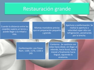 Restauración grande
Cuando la distancia entre las
cúspides supera un tercio y
puede llegar a la mitad o
más.

Mismas maniobras previas
que en preparación pequeña
y grande.

Conformación: con fresas
Núm. 1169, 1170, 1156 o
245

Apertura y conformación: Se
realiza la apertura a
velocidad súper alta con
refrigeración, penetrando
por la brecha.

Contorno: Se continúa con
estas hacia distal, sin llegar al
reborde, hacia bucal, hacia
mesial y finalmente hacia
lingual, siguiendo la
anatomía.

 