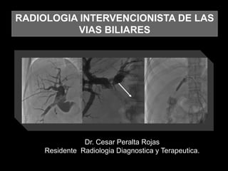 RADIOLOGIA INTERVENCIONISTA DE LAS
VIAS BILIARES
Dr. Cesar Peralta Rojas
Residente Radiologia Diagnostica y Terapeutica.
 